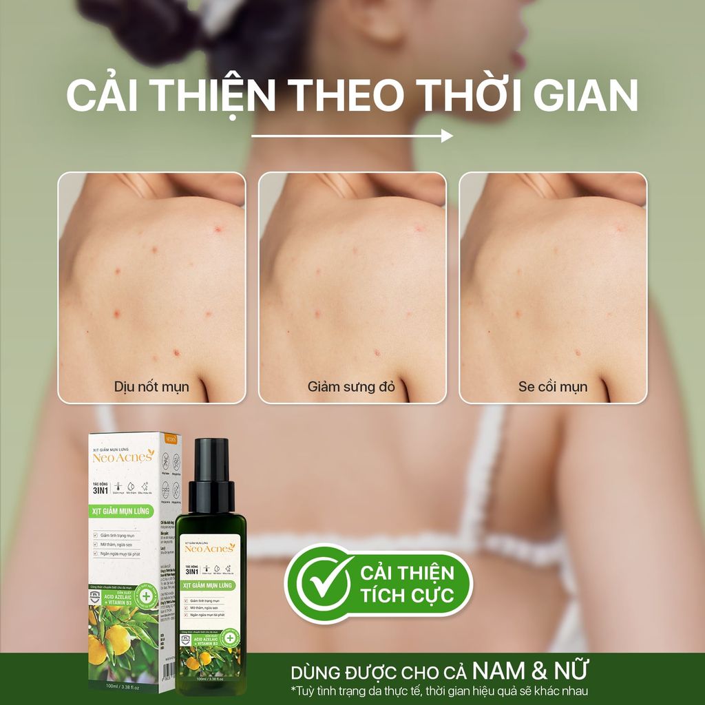 Xịt giảm mụn lưng NeoAcnes - Hỗ trợ giảm mụn cơ thể, giảm mụn lưng và ngừa thâm sẹo (100ml)