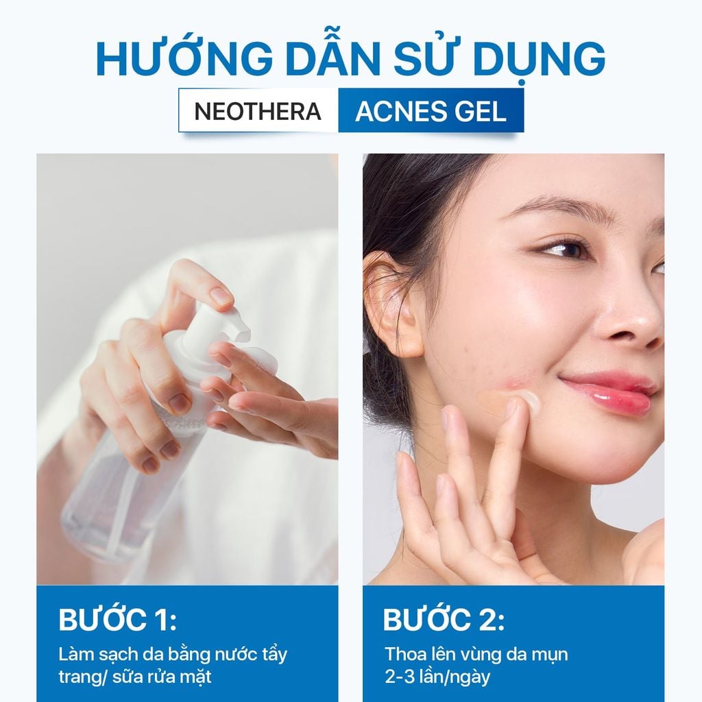Gel Giảm Mụn Thâm, Sẹo Mụn & Cải Thiện Da Dầu, Mụn Neothera Acnes Gel (15ml)