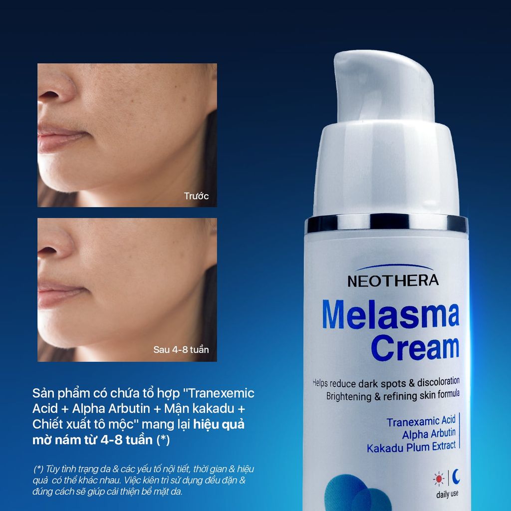 Kem Giảm Nám Da Chuẩn Khoa Học Triple Action T.A.K Hiệu Quả Chỉ Sau 7 Ngày NEOTHERA MELASMA CREAM 30ml (Chai)