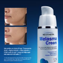 Kem Giảm Nám Da Chuẩn Khoa Học Triple Action T.A.K Hiệu Quả Chỉ Sau 7 Ngày NEOTHERA MELASMA CREAM 30ml (Chai)