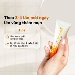 Combo 3 Tuýp Gel Nghệ Nano NeoCurma – Giảm Mụn, Mờ Thâm Sẹo (20g/Tuýp)