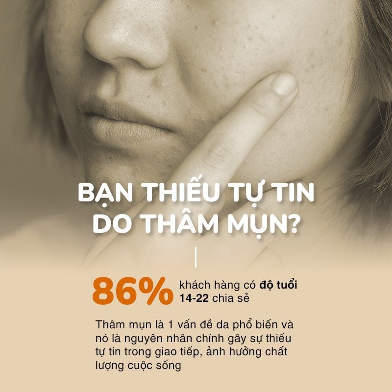 Combo 3 Tuýp Gel Nghệ Nano NeoCurma – Giảm Mụn, Mờ Thâm Sẹo (20g/Tuýp)
