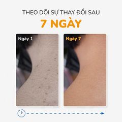 Xà Phòng Giảm Mụn Thâm Lưng Mông Nghệ Curcumin & Tràm Trà NeoAcnes (75g)