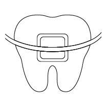 Chỉnh Nha