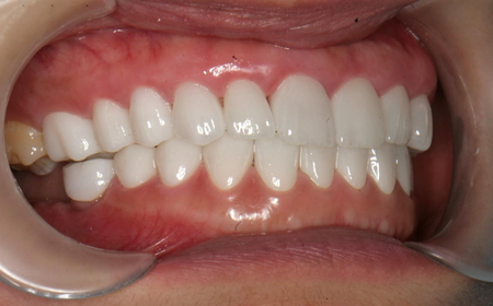 BN. Kim Ngân Compare