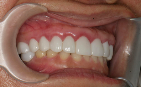 BN. Kim Ngân Compare 2