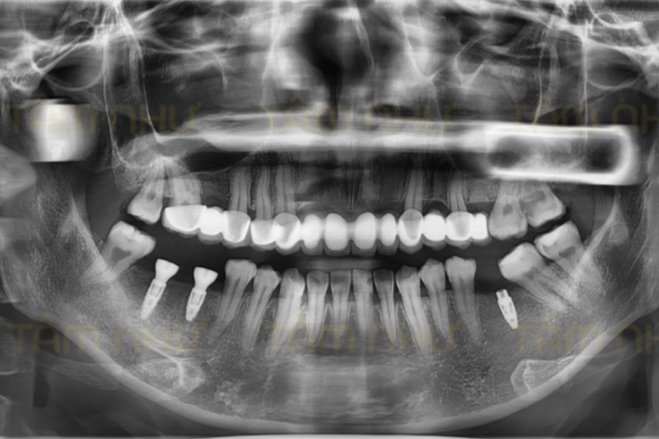 BN.Thúy Hằng Compare