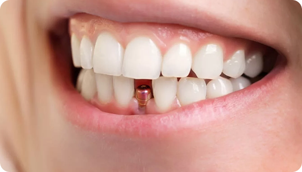 Điều Trị - Phục Hồi