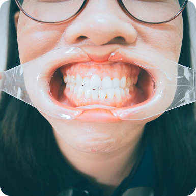 Điều Trị - Phục Hồi