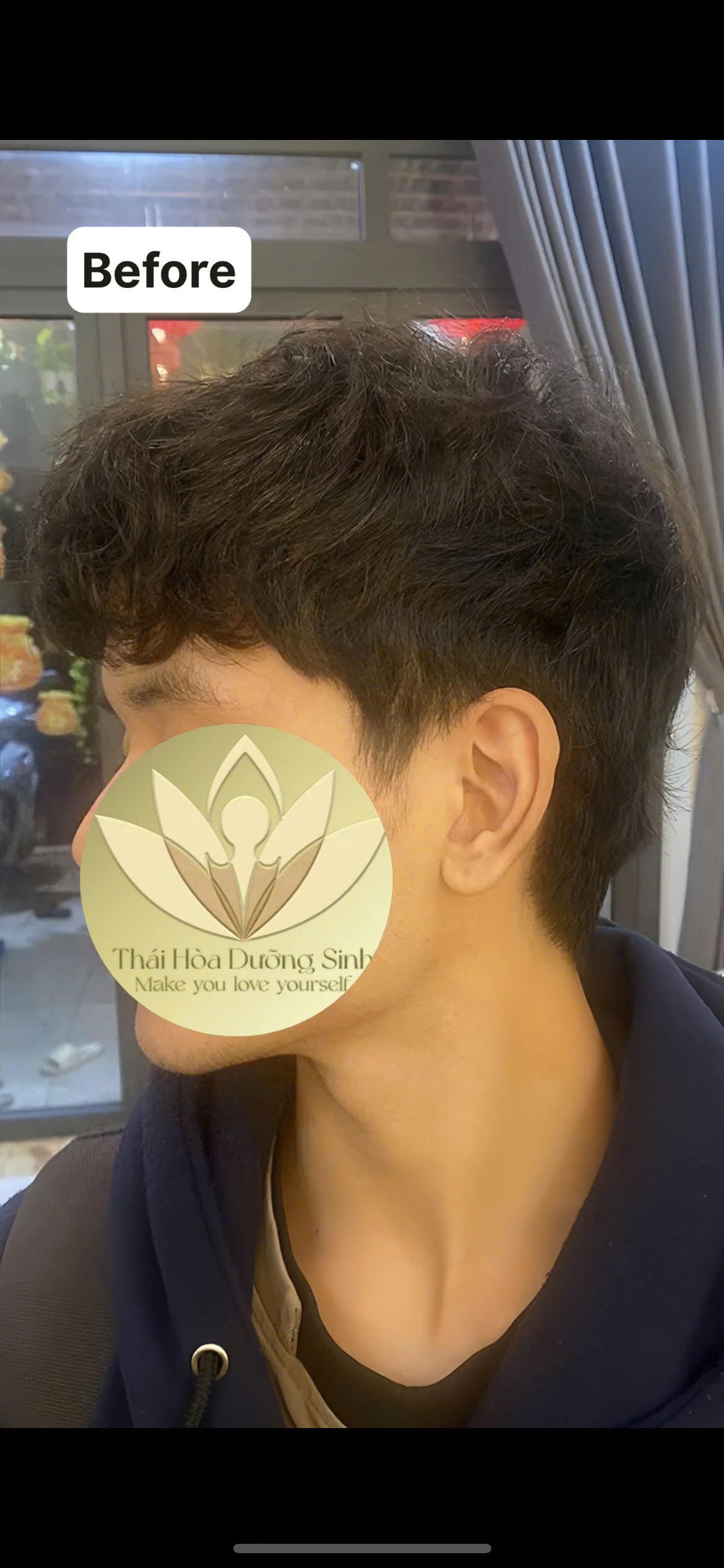 Trước khi nhuộm bằng Thái Hòa Herbal Black Supreme